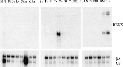 Fig. 2. Tissue distribution of REDK message. / PolyA + RNA multiple-tissue Northern blots were hybridized to the REDK cDNA probe fragment. Hybridizations to probes for β-actin and G3PDH are shown to illustrate loading consistency. H, heart; B, brain; Pl, placenta; Lu, lung; Lv, liver; Skm, skeletal muscle; K, kidney; Pn, pancreas; Sp, spleen; Th, thymus; Pr, prostate; Ts, testis; Ov, ovary; SI, small intestine; C, colon; PBL, peripheral blood leukocytes; LN, lymph node; BM, bone marrow; fLv, fetal liver.