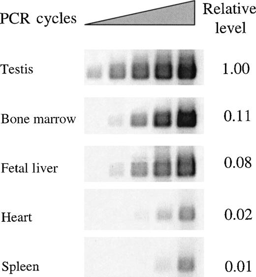 Fig. 4. Semiquantitative RT-PCR determination of REDK mRNA expression in different tissues. / Total REDK PCR primer set was used to amplify a RED-specific product of 466 nucleotides after first-strand cDNA synthesis from pA + RNA. Bands produced during exponential amplification were volume quantified and normalized to a G3PDH-specific product.