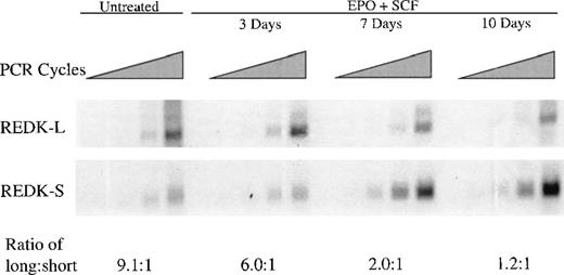 Fig. 6. Expression of REDK in CD34+ cells during erythroid differentiation. / Purified CD34+ cells were seeded in medium (20% FBS) containing 4 U/mL EPO and 50 ng/mL SCF. Cells were harvested for RNA extraction at the days indicated, and RT-PCR analysis was performed with REDK-L– and REDK-S–specific primers. Quantitation of the relative expression of the REDK-L and REDK-S messages was determined based on normalization to G3PDH.