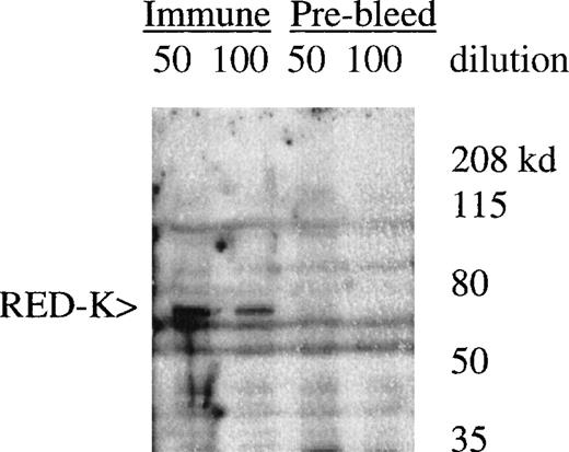 Fig. 7. Detection of REDK protein by peptide antisera. / Whole-cell lysate from UT7-EPO cells was blotted with rabbit preimmune and immune sera after immunization with the Y3-52 peptide. The predicted molecular mass for REDK is 67 kd.