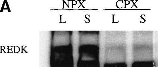 Fig. 8. REDK is predominantly a nuclear protein. / (A) UT7-EPO cells were in log phase (L) or starved for EPO (S) for 2 days. Crude cytoplasmic (CPX) and nuclear protein (NPX) extracts were prepared, and proportionate amounts of cytoplasmic and nuclear protein were transferred to nitrocellulose. The Western was probed with REDK-specific sera and detected by ECL. (B) REDK was immunoprecipitated from companion cytoplasmic and nuclear protein extracts with affinity-purified antisera for REDK and reacted after the addition of 33P-ATP. Products were denatured, electrophoresed, and exposed for imaging. Normalized volumes of protein extracts were loaded so that each lane contained immunoprecipitates from the same number of cells.