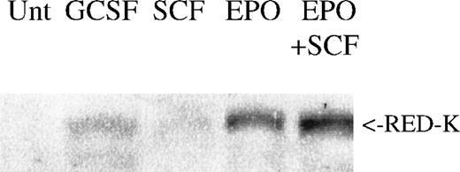 Fig. 9. REDK protein correlates with erythroid differentiation. / Low-density mononuclear cells from a normal human donor were untreated (Unt) or treated for 7 days as shown. Whole-cell protein lysates were analyzed for REDK protein by Western blotting. Comparable results were obtained from multiple donors.