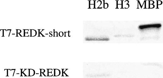 Fig. 10. Recombinant REDK can phosphorylate myelin basic protein and histones. / Nuclear protein extracts from log cells stably transfected with a tagged, recombinant REDK-S (clone S9) were immunoprecipitated by the T7-tag-specific sera. Immunoprecipitates were incubated with P-33-ATP and substrates to assess activity. Samples were collected in the linear range and analyzed as previously.