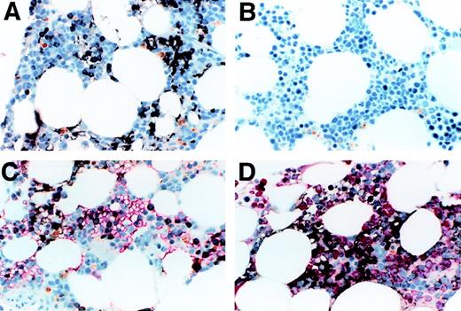 Fig. 1. Immunocytochemistry of normal bone marrow. / (A) shows normal bone marrow stained with anti–Notch-1 antibody. Positive staining is brown-black and the counterstain is a light-blue hematoxylin. Positive staining is seen in the cytoplasm and appears to be on the cell membrane in both erythroid precursors (seen in a patch on the left as a narrow cytoplasmic rim in round cells with round nuclei) and in myeloid precursors (seen in a patch on the right as cytoplasmic staining of polygonal cells). Background staining with an isotype-matched antibody of irrelevant specificity was minimal (B). (C) shows a double stain for Notch-1 and glycophorin, with the latter seen as red. A portion of the glycophorin-staining cells also contained Notch-1. This portion contained mainly the larger more immature glycophorin-staining cells, which the more mature, smaller erythroid precursors did not stain for Notch 1. A few cells in this field contain both. It appears that Notch-1 is lost as the cells mature and gain glycophorin. (D) shows double-staining for Notch-1 and myeloperoxidase, with the myeloperoxidase staining red. The majority of cells in this field are of the granulocytic lineage, staining with myeloperoxidase and sometimes showing polylobulated nuclei characteristic of mature neutrophils. The Notch-1 stained cells appear not to be myeloperoxidase positive, even when lightly stained. Some of the Notch-1 stained cells are clearly small, round erythroid precursors, others have a more polygonal cytoplasmic shape and sometimes a clefted nucleus consistent with a monocytic cell. All photomicrographs were taken at magnification × 60.