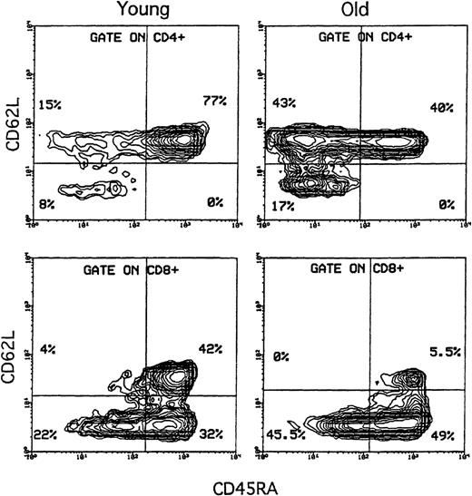 Fig. 1. Evaluation of CD45RA+CD62L+naive T cells in donors of different ages. / Freshly isolated PBMCs were stained with the following combinations of FITC-, PE-, and CyChrome-conjugated mAbs: CD45RA, CD62L, and CD4 or CD8. A representative comparison of 5% probability contour plots from a young (18-year-old) and an old (80-year-old) subject is shown. An electronic gate was set on CD4+ or CD8+ T lymphocytes as indicated, and expression of CD45RA (X axis) was correlated to CD62L (Y axis). In both the CD4 and CD8 subsets, CD45RA+CD62L+ (double-positive) naive T cells (upper-right box) were profoundly reduced in the old subject compared with the young subject; within each of these subjects, the percentage of double-positive cells was higher in the CD4 subset than in the CD8 subset. Moreover, within the CD8 T cells, the proportion of CD45RA+CD62L− cells (lower-right box) showed an important age-dependent increase.