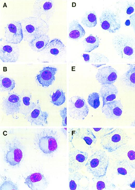 Fig. 2. The effect of TOR and IL-10 on the morphology of monocyte-derived DC. / (A) A macrophage-like appearance of adherent PBMC cultured in a medium for 7 days. (B) Immature DC cultured with IL-4 + GM-CSF for 7 days displaying dendrites and veils on the cell surface. (C) Mature DC cultured with IL-4 + GM-CSF followed by LPS (1 μg/mL) for 24 hours displaying a markedly dendritic surface morphology. (D) Cells cultured with IL-4 + GM-CSF and 5 μmol/L TOR or (E) IL-4 + GM-CSF and 10 μmol/L TOR with an intermediate morphology between macrophages and immature DC, with clearly fewer dendritic processes than immature DC. (F) Cells cultured with IL-4 + GM-CSF and IL-10 (100 U/mL) with a macrophage-like appearance. Magnification ×1000. The results are representative of 5 individual experiments.