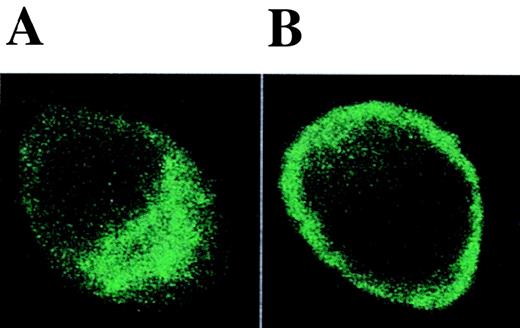 Fig. 10. The effect of TOR on the distribution of CD86 protein. / Adherent PBMC were cultured with (A) IL-4 + GM-CSF or (B) IL-4 + GM-CSF and 5 μmol/L TOR for 48 hours and immunostained with anti-CD86 mAb. Representative ICM images in the x-y plane are shown. Isotype-control mAb staining was negative (not shown).