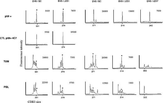 Fig. 7. Detection of p58+ T cells and CTL clone 4C7–specific TCR rearrangements by CDR3 analysis ex vivo in tumor cells and PBMC. / RNA from p58+ T cells, tumor, and PBMC were reverse transcribed and amplified by using a TCRBV6 or TCRBV8 and a BC primer. Amplified DNA was copied in a runoff reaction by using fluorescent BC or BJ primers. The amplified products were analyzed on an automated sequencer. The profiles obtained show the size in nt (x-axis) and fluorescence intensity (y-axis) of the amplified products. The absolute FU values are indicated by asterisks.