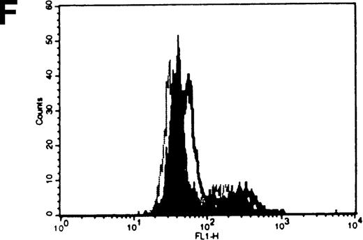 Fig. 8. C6-NBD-SM fluorescence of leukemic blasts following 18-hour culture. / (A) Blasts from pgp−ve patient LC incubated overnight with C6-NBD-SM demonstrate intense fluorescence on the subset of cells defined by region 5 (R5). Backgating of the (B) R4 and (C) R5 subsets demonstrated that R5 C6-NBD-SM high cells were the smaller cells with higher side scatter, typical flow cytometric features of apoptosis.35 The figure is a representative plot of a consistent finding. (D) Histogram of the same sample incubated without (filled plot) and with (unfilled plot) 1 μmol/L PSC-833, which demonstrates an increase in C6-NBD-SM high cells. (E, F) C6-NBD-SM–loaded blasts from pgp+ve patients (E) GO and (F) RF demonstrate a fluorescence shift in the entire population as well as in the fluorescence-high subset when untreated samples (filled plots) are compared to samples treated with PSC-833 (unfilled plot, thick line). (F) The lowering effect of UIC2 (unfilled plot, dotted line) on C6-NBD-SM fluorescence is also shown.