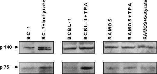 Fig. 1. Expression of high-affinity and low-affinity NGF receptors by HHV-8+ and HHV-8− B-lymphoma cell lines. / The expression of high-affinity (p140trk-A) and low-affinity (p75NGFR) NGF receptors by B-lymphoma cell lines HHV-8+ (BC-1 and BCBL-1 cells) and HHV-8− (RAMOS cells) is shown. Western blot analysis was performed, and immunostaining was completed with anti-p140 and anti-p75 antibodies of proteins (100 μg/sample) from untreated cells and BC-1 cells treated with 3 mmol/L sodium butyrate and BCBL-1 cells treated with 20 ng/mL TPA at 48 hours of culture.