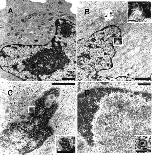 Fig. 7. Transmission electron microscopy of HHV-8 virions in TPA-treated BCBL-1 cells at 48 hours of culture. / The following cells are depicted: (A) untreated cells, (B) cells treated with 20 ng/mL TPA at 0 hour, (C) cells treated with TPA plus 5 ng/mL hr-NGF at 0 hour, and (D) cells treated with TPA plus 30 μg/mL anti-NGF Ab at 0 and 24 hours. (A) No HHV-8 viral particles were observed in control cells. (B) Mature enveloped virions originated from the nucleus of a TPA-treated cell. A detail, at higher magnification, is shown in the corner. (C) View of numerous mature HHV-8 virions, approximately 110 nm in diameter, in the nucleus of a cell treated with TPA plus hr-NGF. A detail, at higher magnification, is shown in the corner. (D) Nucleus of an apoptotic cell in a culture treated with TPA plus anti-NGF Ab. The condensed chromatin of the apoptotic cell can be seen along the nuclear membrane. Numerous defective virus particles, with internal electron dense structures possibly representing viral DNA, were observed. A detail of a defective virion can be seen at higher magnification in the corner. The bars in (A, B) equal 1 μm; in (C, D), 0.5 μm; and in the corners, 150 nm.