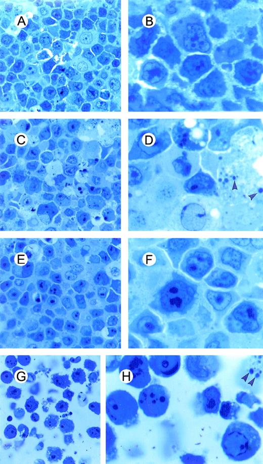 Fig. 6. Light microscopy of BCBL-1 cells treated with TPA plus hr-NGF or anti-NGF Ab and observed at 48 hours of culture. / Semithin sections of cells were embedded in Spurr epoxy resin and stained with methylene blue as shown: (A, B) untreated cells, (C, D) cells treated with 20 ng/mL TPA at 0 hour, (E, F) cells treated with TPA plus 5 ng/mL hr-NGF at 0 hour, and (G, H) cells treated with TPA plus 30 μg/mL anti-NGF Ab at 0 and 24 hours. (Original magnification ×40 in A, C, E, and G, and ×100 in B, D, F, and H. (C, D) Numerous cells showing aggregation of dense masses of chromatin beneath the nuclear membrane and nuclear fragmentation were observed. (E, F) Only a few cells showed morphological evidence of apoptosis, and (G, H) a high number of apoptotic cells were observed. Arrowheads indicate apoptotic bodies.