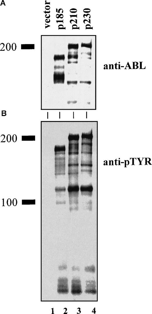 Fig. 1. Expression of p230 Bcr-Abl in 32D mouse myeloid cells leads to tyrosine phosphorylation of cellular proteins. / Lysates of 32D cells expressing empty vector (lane 1), p185 (lane 2), p210 (lane 3), and p230 Bcr-Abl (lane 4) were analyzed by Western blotting with antibodies against (A) Abl (8E9, Pharmingen) or (B) phosphotyrosine (4G10, UBI).