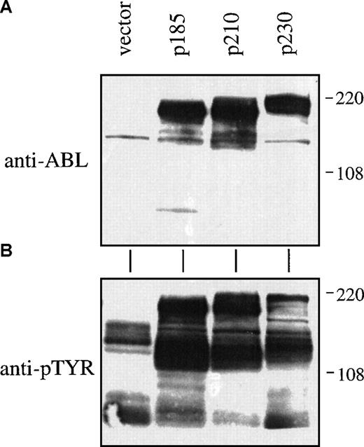 Fig. 2. Expression of P230 Bcr-Abl in primary mouse bone marrow cells leads to tyrosine phosphorylation of cellular proteins. / Whole cell lysates were prepared from cytokine and serum-starved primary mouse bone marrow cells by boiling in 2 × sample buffer. Lysates were analyzed by SDS-PAGE and Western blotting with antibodies against (A) Abl or (B) phosphotyrosine.