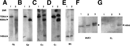 Fig. 2. Characterization of the IGH rearrangements in SKI-DLCL-1 by PFGE. / High molecular weight DNA from peripheral blood lymphocytes (lane 1) and SKI-DLCL-1 cells (lane 2) was digested with NotI and resolved through PFGE with a window of resolution of 50 kb to 1500 kb (A-E) or 25 to 500 kb (F, G). The identical blot was sequentially hybridized with a series of probes, as indicated in A to E. A second blot was used (F, G) for hybridization by the indicated probes. The samples are as follows: lane 1, PBL; lane 2, ascitic fluid; lane 3, SKI-DLCL-1. Complete removal of the different probes after stripping was confirmed by exposure to film. ZNR, zone of no resolution.