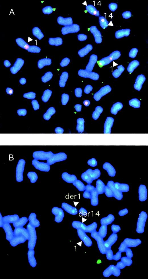Fig. 4. Characterization of genomic clones by FISH. / (A) FISH analysis of normal cells using cosmid clone S7D, a candidate to span the t(1;14) breakpoint. Biotinylated probes for the chromosome 14 centromere-specific probe and the heterochromatic region of chromosome 1 were cohybridized with digoxigenin dUTP-labeled clone S7D. The centromeric and heterochromatic regions were identified with phycoerythrin-SA (red) and the breakpoint probe with FITC-antidigoxigenin (green). The result confirmed that clone S7D split the breakpoint. (B) FISH analysis of SKI-DLCL-1 cells using P1 PAC clone 35(A12) derived from the normal chromosome 1. The P1 PAC clone 35(A12) probe was labeled with digoxigenin dUTP and detected by FITC-antidigoxigenin. The finding of signals on the normal chromosome 1 and on the der(1) and der(14) chromosomes confirms that P1 spans the region on chromosome 1 involved with the breakpoint.