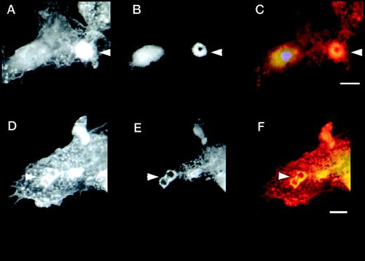 Fig. 2. Defective formation of phagocytic cups in WAS macrophages and recruitment of WASp during IgG-mediated phagocytosis. (A-C and D-F) Two examples of phagocytic cup formation in normal macrophages incubated with IgG-coated latex beads (arrowheads). Cells were stained with rhodamine-phalloidin to show the distribution of F-actin (A and D, red) and FITC-PY20 to show tyrosine phosphorylation (B and E, green). Merged images (C and F) show co-localization (yellow) of the 2 signals. (G-I and J-L) Two examples of phagocytic cup formation (arrowheads) in WAS macrophages showing F-actin. (G and J, rhodamine phalloidin) and tyrosine phosphorylation (H and K, FITC-PY20). Merged images are also shown (I and L). In contrast to normal phagocytic cups, those of WAS macrophages are deficient in F-actin, giving the appearance of black disks surrounded by a less well-formed rim. Furthermore, there is no apparent accumulation of tyrosine phosphorylated proteins in the region of the phagocytic cup. (M and N) Expression of EGFP (M) and EGFP-WASp fusion protein (N) in Cos7 cells transiently transfected with plasmid vectors pEGFP-C2 and pEGFP-WASp, respectively. (O-U) Distribution of EGFP-WASp and actin in transfected normal human macrophages. Primary human macrophages transfected with plasmid vector pEGFP-WASp show accentuated cortical staining and co-localization of EGFP-WASp with F-actin (EGFP-rhodamine phalloidin merged image (O). (P-R and S-U) Two examples of transfected macrophages incubated with IgG-coated latex beads are shown. (P and S) EGFP-WASp fusion protein, visualized using a FITC filter. (Q and T) Rhodamine-phalloidin staining of F-actin. (R and U) The merged images and sites of co-localization of EGFP-WASp fusion protein and F-actin (yellow). An untransfected cell is also shown alongside a cell expressing EGFP-WASp (S-U). In cells containing phagocytosed latex beads, EGFP-WASp and F-actin both accumulate around the particles, although some remained co-localized with F actin-rich cortical areas in these cells. The scale bar represent 5μm.