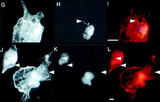 Fig. 2. Defective formation of phagocytic cups in WAS macrophages and recruitment of WASp during IgG-mediated phagocytosis. (A-C and D-F) Two examples of phagocytic cup formation in normal macrophages incubated with IgG-coated latex beads (arrowheads). Cells were stained with rhodamine-phalloidin to show the distribution of F-actin (A and D, red) and FITC-PY20 to show tyrosine phosphorylation (B and E, green). Merged images (C and F) show co-localization (yellow) of the 2 signals. (G-I and J-L) Two examples of phagocytic cup formation (arrowheads) in WAS macrophages showing F-actin. (G and J, rhodamine phalloidin) and tyrosine phosphorylation (H and K, FITC-PY20). Merged images are also shown (I and L). In contrast to normal phagocytic cups, those of WAS macrophages are deficient in F-actin, giving the appearance of black disks surrounded by a less well-formed rim. Furthermore, there is no apparent accumulation of tyrosine phosphorylated proteins in the region of the phagocytic cup. (M and N) Expression of EGFP (M) and EGFP-WASp fusion protein (N) in Cos7 cells transiently transfected with plasmid vectors pEGFP-C2 and pEGFP-WASp, respectively. (O-U) Distribution of EGFP-WASp and actin in transfected normal human macrophages. Primary human macrophages transfected with plasmid vector pEGFP-WASp show accentuated cortical staining and co-localization of EGFP-WASp with F-actin (EGFP-rhodamine phalloidin merged image (O). (P-R and S-U) Two examples of transfected macrophages incubated with IgG-coated latex beads are shown. (P and S) EGFP-WASp fusion protein, visualized using a FITC filter. (Q and T) Rhodamine-phalloidin staining of F-actin. (R and U) The merged images and sites of co-localization of EGFP-WASp fusion protein and F-actin (yellow). An untransfected cell is also shown alongside a cell expressing EGFP-WASp (S-U). In cells containing phagocytosed latex beads, EGFP-WASp and F-actin both accumulate around the particles, although some remained co-localized with F actin-rich cortical areas in these cells. The scale bar represent 5μm.