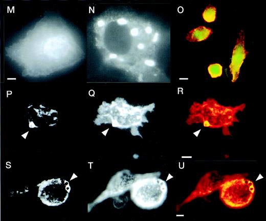 Fig. 2. Defective formation of phagocytic cups in WAS macrophages and recruitment of WASp during IgG-mediated phagocytosis. (A-C and D-F) Two examples of phagocytic cup formation in normal macrophages incubated with IgG-coated latex beads (arrowheads). Cells were stained with rhodamine-phalloidin to show the distribution of F-actin (A and D, red) and FITC-PY20 to show tyrosine phosphorylation (B and E, green). Merged images (C and F) show co-localization (yellow) of the 2 signals. (G-I and J-L) Two examples of phagocytic cup formation (arrowheads) in WAS macrophages showing F-actin. (G and J, rhodamine phalloidin) and tyrosine phosphorylation (H and K, FITC-PY20). Merged images are also shown (I and L). In contrast to normal phagocytic cups, those of WAS macrophages are deficient in F-actin, giving the appearance of black disks surrounded by a less well-formed rim. Furthermore, there is no apparent accumulation of tyrosine phosphorylated proteins in the region of the phagocytic cup. (M and N) Expression of EGFP (M) and EGFP-WASp fusion protein (N) in Cos7 cells transiently transfected with plasmid vectors pEGFP-C2 and pEGFP-WASp, respectively. (O-U) Distribution of EGFP-WASp and actin in transfected normal human macrophages. Primary human macrophages transfected with plasmid vector pEGFP-WASp show accentuated cortical staining and co-localization of EGFP-WASp with F-actin (EGFP-rhodamine phalloidin merged image (O). (P-R and S-U) Two examples of transfected macrophages incubated with IgG-coated latex beads are shown. (P and S) EGFP-WASp fusion protein, visualized using a FITC filter. (Q and T) Rhodamine-phalloidin staining of F-actin. (R and U) The merged images and sites of co-localization of EGFP-WASp fusion protein and F-actin (yellow). An untransfected cell is also shown alongside a cell expressing EGFP-WASp (S-U). In cells containing phagocytosed latex beads, EGFP-WASp and F-actin both accumulate around the particles, although some remained co-localized with F actin-rich cortical areas in these cells. The scale bar represent 5μm.
