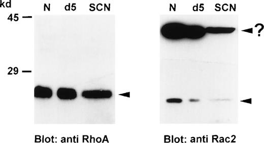 Fig. 1. Expression of GTPases, RhoA and Rac2, in neutrophils from healthy individuals and SCN patients. / Neutrophil lysates (50 μg protein each) were separated on a 8% SDS-PAGE, blotted onto nitrocellulose membranes, and detected with anti-RhoA or anti-Rac2 antibodies. These results were representative for 6 independent experiments with cells from 3 SCN patients, 3 G-CSF-treated individuals, and 6 untreated healthy individuals. N indicates normal neutrophils; SCN, patients' neutrophils; and d5, in vivo-stimulated neutrophils from a healthy donor.