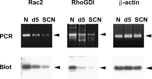 Fig. 3. Semiquantitative RT-PCR analysis of Rac2 and RhoGDI mRNA expression in neutrophils from healthy individuals and SCN patients. / RNA was isolated from neutrophils27 and RT-PCR was performed using specific primers for Rac2 or RhoGDI, respectively. PCR products were separated by agarose gel electrophoresis and blotted onto nylon membranes. Specific products were hybridized with DIG-labeled internal oligonucleotides specific for Rac2 or RhoGDI, respectively, and detection was performed with anti-DIG antibodies and the chemiluminescent substrate CDP-Star. As a control β-actin expression was tested. These results were representative for 5 independent experiments with cells from 2 SCN patients, 2 G-CSF- treated individuals, and 3 untreated healthy individuals. N indicates normal neutrophils; SCN, patients' neutrophils; and d5, in vivo stimulated neutrophils from a healthy donor.