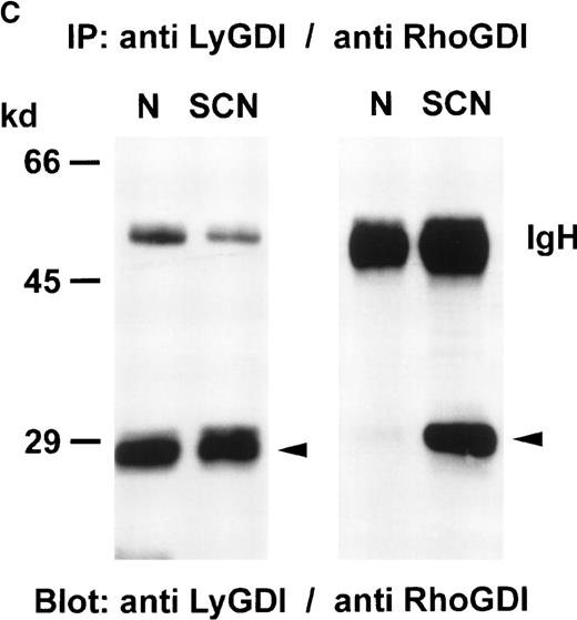 Fig. 4. Association of GTPases and GDIs in neutrophils from healthy individuals and SCN patients. / GDIs were immunoprecipitated from neutrophil cytosol (500 μg protein each), separated on a 8% SDS-PAGE, blotted onto nitrocellulose membranes and detected with (A) anti-Rac2 antibody, (B) anti-RhoA antibody, or (C) anti-LyGDI or anti-RhoGDI antibodies. These results were representative for 3 independent experiments with cells from 3 SCN patients and 3 healthy individuals. N indicates normal neutrophils, and SCN, patients' neutrophils.