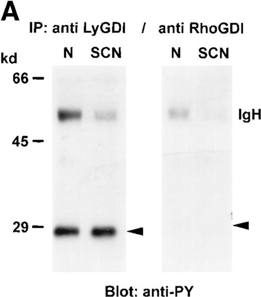 Fig. 5. Tyrosine phosphorylation of GDIs in neutrophils from healthy individuals and SCN patients. / GDIs were immunoprecipitated from neutrophil cytosol (500 μg protein each), separated on a 8% SDS-PAGE, blotted onto nitrocellulose membranes, and detected with (A) anti-PY antibody, or (B) anti-LyGDI or anti-RhoGDI antibodies. These results were representative for 3 independent experiments with cells from 3 SCN patients and 3 healthy individuals. N indicates normal neutrophils, and SCN, patients' neutrophils.
