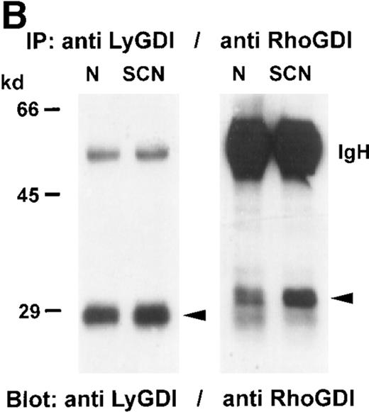 Fig. 5. Tyrosine phosphorylation of GDIs in neutrophils from healthy individuals and SCN patients. / GDIs were immunoprecipitated from neutrophil cytosol (500 μg protein each), separated on a 8% SDS-PAGE, blotted onto nitrocellulose membranes, and detected with (A) anti-PY antibody, or (B) anti-LyGDI or anti-RhoGDI antibodies. These results were representative for 3 independent experiments with cells from 3 SCN patients and 3 healthy individuals. N indicates normal neutrophils, and SCN, patients' neutrophils.