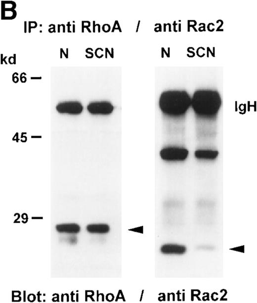Fig. 6. Tyrosine phosphorylation of GTPases in neutrophils from healthy individuals and SCN patients. / GTPases were immunoprecipitated from neutrophil cytosol (500 μg protein each), separated on a 8% SDS-PAGE, blotted onto nitrocellulose membranes, and detected with (A) anti-PY antibody, or (B) anti-RhoA or anti-Rac2 antibodies. These results were representative for 3 independent experiments with cells from 3 SCN patients and 3 healthy individuals. N indicates normal neutrophils, and SCN, patients' neutrophils.