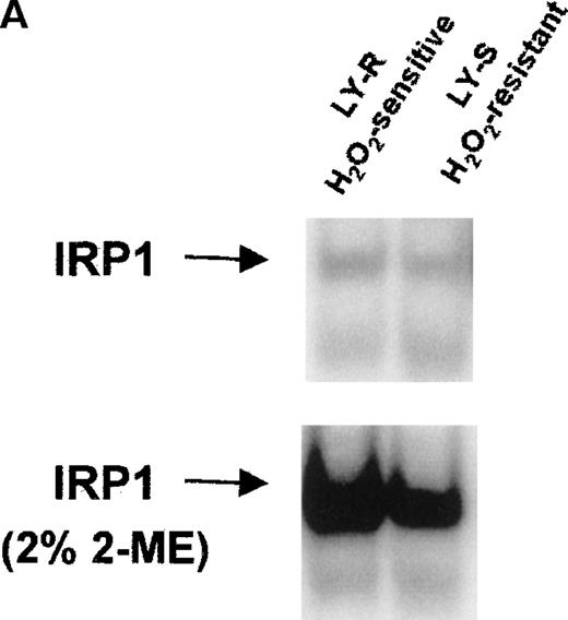 Fig. 3. IRE binding activity of IRP1 and IRP2 in LY cells. (A) Cell extracts were prepared as previously described.1920 Four micrograms of protein were analyzed for IRE binding by IRP1 in the presence or absence of 2% 2-ME. (B) Radioactivity associated with IRE-IRP1 complexes without (open bars) or with (solid bars) 2% 2-ME was quantified with phosphorimaging, and signals are plotted in arbitrary units. (C) Ten micrograms of protein were analyzed for IRE binding by IRP2 in the presence or absence of 0.5% 2-ME. Because signals given by IRP2-IRE complexes are weaker than those of IRP1-IRE complexes, they were amplified and shown separately. Experiments are representative of 5 that gave similar results.