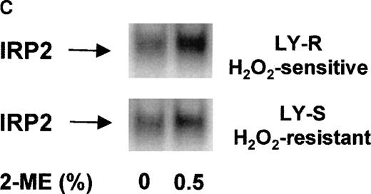 Fig. 3. IRE binding activity of IRP1 and IRP2 in LY cells. (A) Cell extracts were prepared as previously described.1920 Four micrograms of protein were analyzed for IRE binding by IRP1 in the presence or absence of 2% 2-ME. (B) Radioactivity associated with IRE-IRP1 complexes without (open bars) or with (solid bars) 2% 2-ME was quantified with phosphorimaging, and signals are plotted in arbitrary units. (C) Ten micrograms of protein were analyzed for IRE binding by IRP2 in the presence or absence of 0.5% 2-ME. Because signals given by IRP2-IRE complexes are weaker than those of IRP1-IRE complexes, they were amplified and shown separately. Experiments are representative of 5 that gave similar results.
