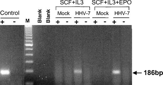 Fig. 4. HHV-7 expression determined by specific RT-PCR in liquid cultures. / RNA was extracted from uninfected (mock) and HHV-7–infected cultures at day 7 of culture. For RT-PCR, equivalent amounts (200 ng) of RNA samples before (−) and after (+) RT were used as template for the amplification reaction with the HV7 and HV8 primers (U10 ORF). Control indicates positive control (RNA from HHV-7–infected SupT1 cells) showing the expected amplification products of 186 bp; lane M, 100-bp ladder of molecular weight marker; blank lanes are samples without RNA. The data are representative of 3 experiments from separate infections.