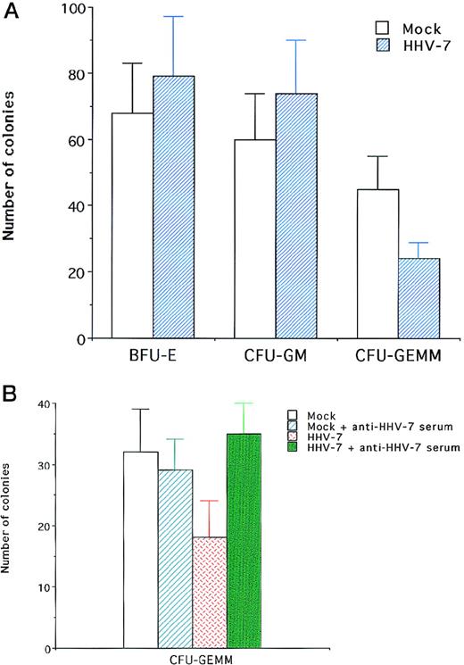 Fig. 1. Effect of HHV-7 on CB CD34–derived clonogenic progenitors. / Data are expressed as means ± SD of 3 to 7 separate experiments performed in triplicate. (A) The number of BFU-E, CFU-GM, and CFU-GEMM, scored after 14 days of semisolid cultures in HHV-7–infected and mock-infected cultures. (B) The effect of pretreatment of HHV-7 inoculum with anti–HHV-7 neutralizing serum on the number of CFU-GEMM.