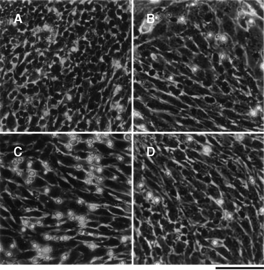 Fig. 1. THS119 cells on TBR59 stromal cells. / THS119 cells were maintained within the TBR59 layer as phase-contrast nonrefractile cells (A) and are also shown in cocultures 3 hours after passage with 5% FBS (B), without FBS (C), or with heat-inactivated 5% FBS (D). Bar indicates 100 μm. THS119 under the stromal cell layer were observed as phase-contrast dark cells. Phase-contrast bright hematopoietic cells were cells in suspension or on the surface of the stromal cells.
