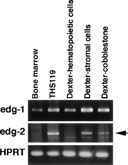 Fig. 6. Expression of edg-1 and edg-2 in long-term bone marrow culture cells. / Cells were obtained from the culture medium (floating hematopoietic cells), or were collected after enzyme treatment, followed by further short-term incubation to separate the stromal cells from the hematopoietic cells in cobblestone areas. Total RNA (0.5 μg) was analyzed by RT-PCR. edg-1, 442 bp fragment specific foredg-1 expression; edg-2, 1139 bp specific fragment foredg-2 expression (arrow); HPRT, 516 bp specific fragment for HPRT expression.