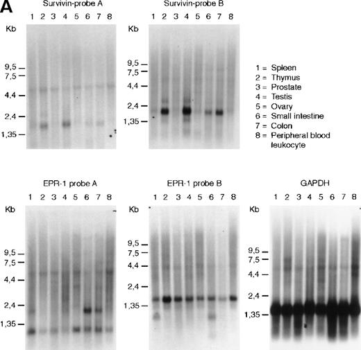 Fig. 1. RNA and genomic analysis of human EPR-1/survivin. / (A) Hybridization of multiple tissue Northern blots (Clontech) withEPR-1 or survivin RNA-specific riboprobes. Probe A is complementary to the first 226 nucleotides of EPR-1 plus the first 94 nucleotides of the intervening sequence. Probe B is complementary to nucleotides 664 to 972 of EPR-1 (GenBank accession number L26245). (B) PCR amplification of survivingenomic DNA sequences from human genomic DNA (upper panel) or of survivin cDNA sequences (lower panel) with 4 different primer sets (see “Materials and methods”). Primer combinations used for the reactions are as follows: lane 1: a-c; lane 2: a-d; lane 3: b-c; lane 4: b-d.
