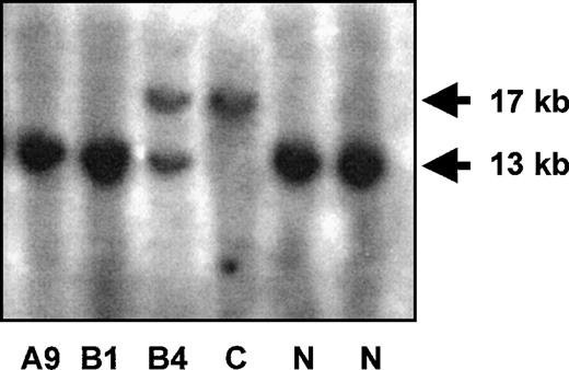 Fig. 2. Southern blot diagnosis of the FGA 11-kb deletion. / The normal fragment detected by probe pAFS1 measures 13 kb, the deleted allele is detected as a 17-kb fragment because 2 BamHI sites are eliminated. The results for 3 patients are shown. C, homozygous deleted control; N, normal control.