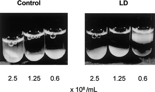 Fig. 3. Platelets from LD retract a fibrin clot. / PRP from a healthy control or patient LD was diluted with autologous plasma to the indicated platelet concentration and clotted by adding 8 mmol/L calcium chloride. After 1 hour of incubation at 37°C, clot retraction of platelets from LD was equivalent to that of control platelets.