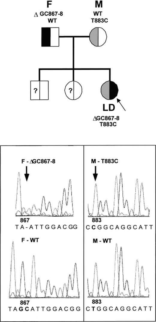 Fig. 4. LD is a compound heterozygote for 2 mutations of the β3 gene. / Analysis of genomic DNA amplified by polymerase chain reaction identified a deletion of GC867-868 in LD's father (F) and a T883C substitution in her mother (M). Both mutant alleles were found in LD. The patient's siblings were not analyzed but are asymptomatic.