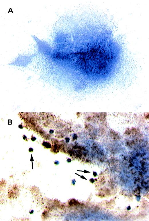 Fig. 3. Results of immunocytochemistry performed on platelets. / (A) The platelets were isolated from circulating blood and deposited on collagen-coated slides. Immunocytochemistry was performed to detect TF. When stained, the platelets did not test positive for TF. Hemotoxylin was used for counter staining. (B) THP-1 cells induced to produce TF and also TF+ microparticles by treatment with TNF-α were perfused over a platelet carpet on a collagen-coated glass slide that was mounted in a parallel plate flow chamber.14The induced THP-1 cells were perfused over the platelets at 500s−1. Note that platelets turned a brown color, indicating TF+, after exposure to TF containing THP-1 cells (original magnification × 200).