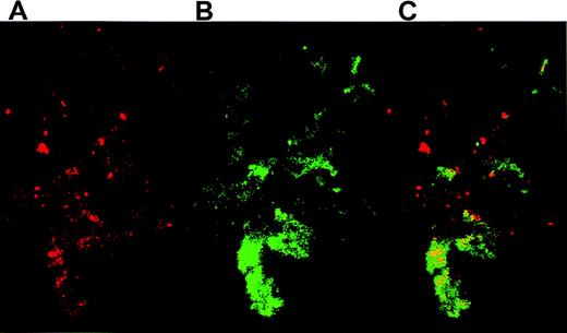 Fig. 4. Platelets activated on collagen were incubated overnight with THP-1 cell–derived TF particles. / The platelet-particle hybrids were then double stained: TF particles on platelets were visualized by anti-TF pAb followed by staining with a secondary goat antirabbit antibody conjugated to PE. The platelets were simultaneously stained by an FITC-conjugated mAb directed against GPIIb. (A) Confocal microscopy reveals TF particles stained red. (B) GPIIb on platelets were stained green. (C) An overlay of panels A and B shows the colocalization of TF and platelets.