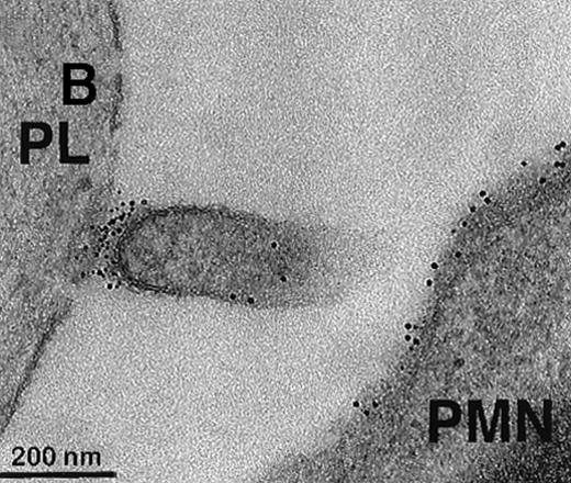 Fig. 1. Collagen-coated glass slides were perfused with native human blood, and the deposited thrombi were double immunostained for TF and CD15. / (A) Electronmicroscopy showing platelets and PMN leukocytes within a thrombus. Note the PMN leukocyte–derived membrane attached to the platelet surface depicted in the boxed field. (B) Closeup examination of the boxed field: the structure double stains for CD15 (10-nm gold grains) and TF (5-nm gold grains). (C) TF on small particle-like structures in proximity to PMN leukocytes.