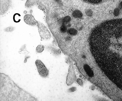 Fig. 1. Collagen-coated glass slides were perfused with native human blood, and the deposited thrombi were double immunostained for TF and CD15. / (A) Electronmicroscopy showing platelets and PMN leukocytes within a thrombus. Note the PMN leukocyte–derived membrane attached to the platelet surface depicted in the boxed field. (B) Closeup examination of the boxed field: the structure double stains for CD15 (10-nm gold grains) and TF (5-nm gold grains). (C) TF on small particle-like structures in proximity to PMN leukocytes.