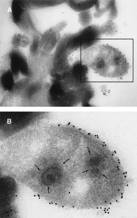Fig. 2. Ultrathin cryosections through a human venous thrombus. / TF within the thrombus was detected by on-section labeling using mAb anti-TF (hTF1) followed by goat antimouse IgG conjugated to 10-nm colloidal gold. (A) Electronmicroscopy shows TF+ cell fragments adjacent to the fibrin strands. (B) Closeup of the region in the boxed field: a clearly discernible bilayered cell membrane and organelle substructure are indicative of the cellular origin of the TF+ structures.