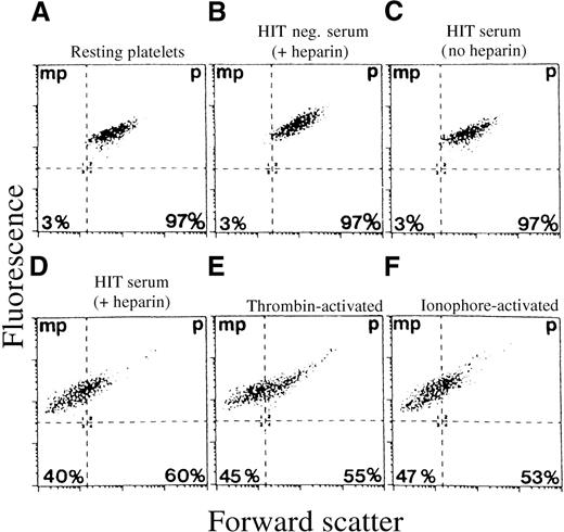 Fig. 1. Flow cytometric analysis of platelets activated with HIT sera, thrombin, and calcium ionophore. / Platelets (p) and microparticles (mp) were identified using fluorescence (FL1, FITC anti-GPIbα) (y-axis) and size (FSC) (x-axis) characteristics. Control platelets included; (A) platelets incubated in buffer alone; (B) platelets incubated with patient serum, which tested negative for HIT, in the presence of 0.1 U/ml heparin; and (C) platelets incubated with HIT serum with no heparin added. (D) Platelets were incubated with HIT serum in the presence of 0.1 U/ml heparin. (E) As a positive control, platelets were also incubated with 1 U/mL thrombin or (D) 10 μm calcium ionophore A23187. Microparticles (MP) were generated with heparin-induced thrombocytopenia serum, thrombin, and calcium ionophore and not with the control serum. The percent of microparticles (the percent of fluorescent events in the microparticle gate) generated by HIT serum was 40%; thrombin, 45%; and calcium ionophore, 47%. The results of a representative experiment are shown.