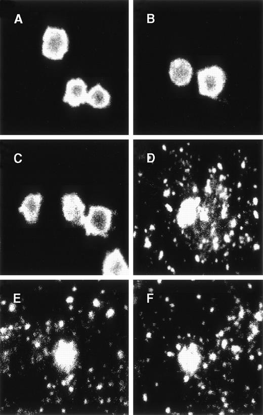 Fig. 2. Confocal microscopy images of microparticles generated by HIT serum, thrombin, and calcium ionophore. / Platelets and microparticles were identified using a platelet-specific primary antibody (mAb anti-GPIIb/IIIa) and a fluorescent secondary antibody (TR-conjugated goat antimouse). (A) Control platelets were incubated with patient serum, which tested negative for HIT in the presence of 0.1 U/mL heparin, (B) heparin alone, and (C) HIT serum in the absence of heparin. (D) Platelets were incubated with HIT serum in the presence of 0.1 U/mL heparin. As a positive control, (E) platelets were also incubated with 1 U/mL thrombin or (F) 10 μm calcium ionophore A23187. Platelet reactions with HIT serum in the presence of heparin demonstrated numerous brightly stained particles surrounding homogeneously stained platelets. This “starry sky pattern” was also observed in platelet reactions with thrombin and calcium ionophore. In comparison, very few stained particles were observed in platelet reactions with control serum or heparin alone. The results of a representative experiment are shown.