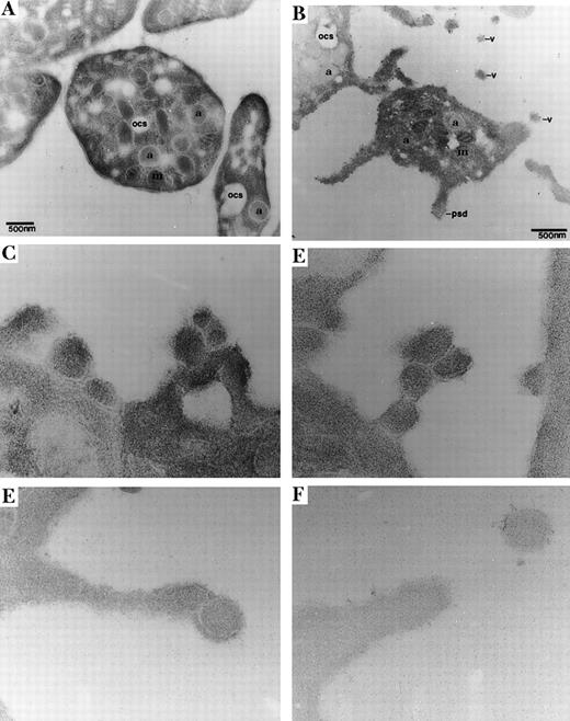 Fig. 3. Representative transmission electron micrographs of resting platelets and platelets incubated with HIT serum. / Resting platelets or platelets incubated with HIT serum in the presence of 0.1 U/mL heparin were fixed with 0.5% glutaraldehyde and embedded in glycolmethacrylate. (A) The morphology of a representative normal resting platelet. Alpha granules (a), mitochondria (m), and channels of the open-cannalicular system (ocs) can be seen throughout the platelet. The platelets appear round or discoid in shape, and there is an absence of pseudopodia. (B-F) The morphology of representative platelets incubated with HIT serum in the presence of heparin. Platelets are activated with a centralized clustering of alpha granules (a) and mitochondria (m). (B) Pseudopodia (psd) can be seen extending from the platelet body, and several distinct membrane-bound structures resembling small vesicles (v) are observed near the platelet. Numerous pseudopodia demonstrated a region of bulging (E) at the terminal end of the pseudopod or (C) along the body of the pseudopod. Frequently, several areas of bulging were observed on (D) the same pseudopod and (C) the platelet body itself. (F) In these platelets, microparticles appeared to be released by the budding of pseudopods. (Original magnification (A, B) × 15 000; (C, D) × 25 000; and (E, F) × 50 000.)