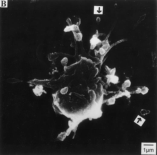 Fig. 4. Representative scanning electron micrographs of resting platelets and platelets activated with HIT serum in the presence of heparin. / Resting platelets or platelets incubated with HIT serum in the presence of 0.1 U/mL heparin were fixed with 2% glutaraldehyde and processed for SEM. (A) The morphology of a representative normal resting platelet. Resting platelets were observed to generally maintain a discoid form. (B) The morphology of a representative platelet incubated with HIT serum. These platelets demonstrated several morphological changes including absence of a discoid form,1 presence of pseudopodia,2 and presence of microparticles near the ends of pseudopodia3 (indicated by arrows). (C) Microparticles that are clearly distinct and separate from the platelet body localize near the terminal end of a pseudopod (indicated by arrow).