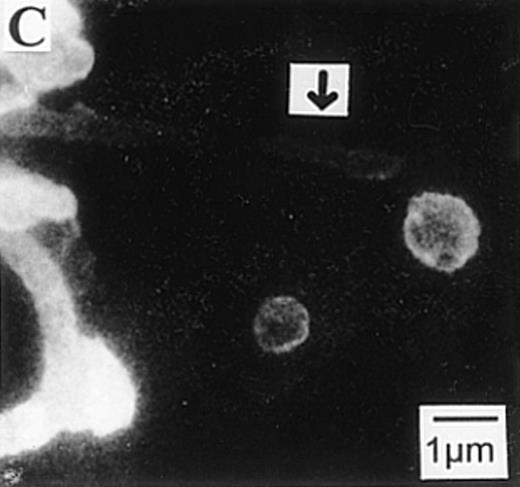 Fig. 4. Representative scanning electron micrographs of resting platelets and platelets activated with HIT serum in the presence of heparin. / Resting platelets or platelets incubated with HIT serum in the presence of 0.1 U/mL heparin were fixed with 2% glutaraldehyde and processed for SEM. (A) The morphology of a representative normal resting platelet. Resting platelets were observed to generally maintain a discoid form. (B) The morphology of a representative platelet incubated with HIT serum. These platelets demonstrated several morphological changes including absence of a discoid form,1 presence of pseudopodia,2 and presence of microparticles near the ends of pseudopodia3 (indicated by arrows). (C) Microparticles that are clearly distinct and separate from the platelet body localize near the terminal end of a pseudopod (indicated by arrow).