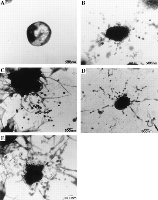 Fig. 5. Electron micrographs of negatively stained platelets activated in situ with HIT sera. / Platelets were allowed to settle on BSA-coated formvar grids and then incubated with patient serum or platelet agonists. (A) Control platelets were incubated with patient serum, which tested negative for HIT, or heparin alone (data not shown). (B) Platelets were inoculated with HIT serum in the presence of 0.1 μ/mL heparin. As a positive control, platelets were also incubated with (C) 1 U/mL thrombin or (D) 10 μm calcium ionophore A23187. Platelets were then fixed with 2% glutaraldehyde and negatively stained with 2% phosphotungstic acid. (A) Control platelets demonstrated a round or discoid shape, which is characteristic of resting platelets. (B) Platelets incubated with HIT serum demonstrated numerous microparticles surrounding the platelet body. Frequently, these platelets were observed with pseudopodia extending from the platelet body. Microparticles ranged in size from less than 0.1 to 1.0 μm in diameter and appeared as discrete membrane-bound particles. Platelets incubated with (C) thrombin and (D) calcium ionophore demonstrated a similar platelet morphology, with microparticles surrounding the platelet body. (Original magnification (A-E) × 13 000.) (E) These particles were observed to be near the terminal ends and body of the pseudopods, and numerous points of bulging or swelling along the body and terminal ends of the pseudopodia were observed.